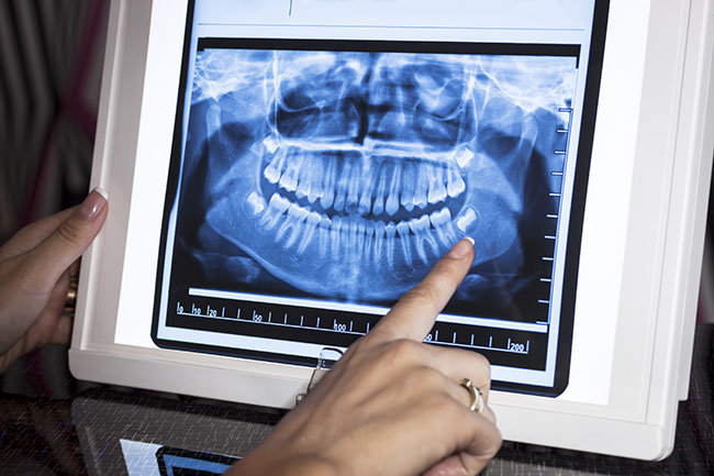 dental xrays