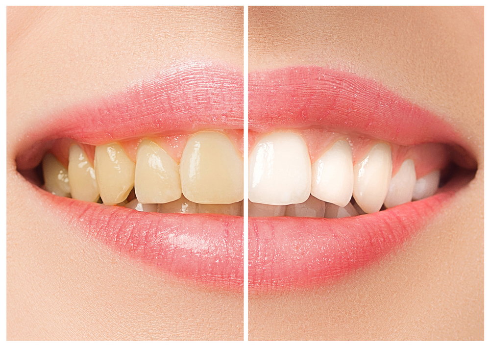 shutterstock_655409992